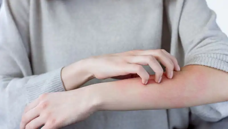Cilt Kanserinin Gözden Kaçan Belirtileri: Dermatologdan Kritik Uyarılar