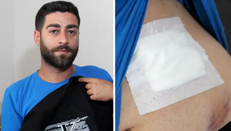 Karnındaki Ağrı Nedenini Öğrenmek İsteyen Kadın Röntgenle Şok Oldu!