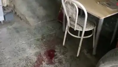 Sandalyeden Düşen Adamın Hayatı Değişti: Ağır Yaralanma Sonrası Mücadele