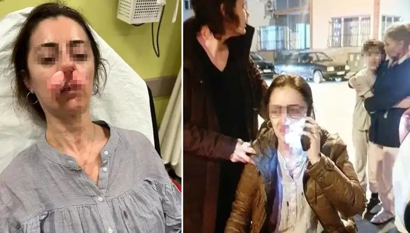 Otomobil Kapısı Silah Sayıldı: Kıskançlık Krizi Aracın Kapısıyla Son Buldu!