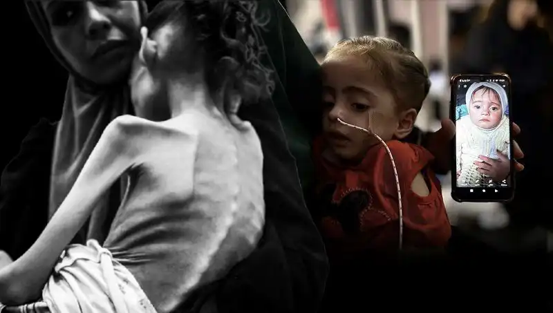 Küçük Meryem'in Hikayesi: 25 Kilodan 10 Kiloya Düşen Çocuk Açlıkla Mücadele Ediyor