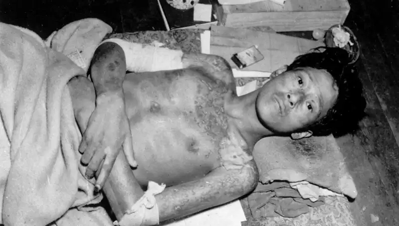 80 Yıl Sonra Nagasaki'den Şok Edici Uyarı: Nükleer Felaket Alarmı!