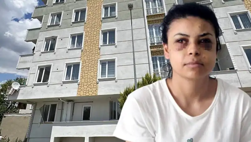 Düğünde Maganda Dehşeti: Çiçeği Burnunda Gelin Tüfekle Yaralandı